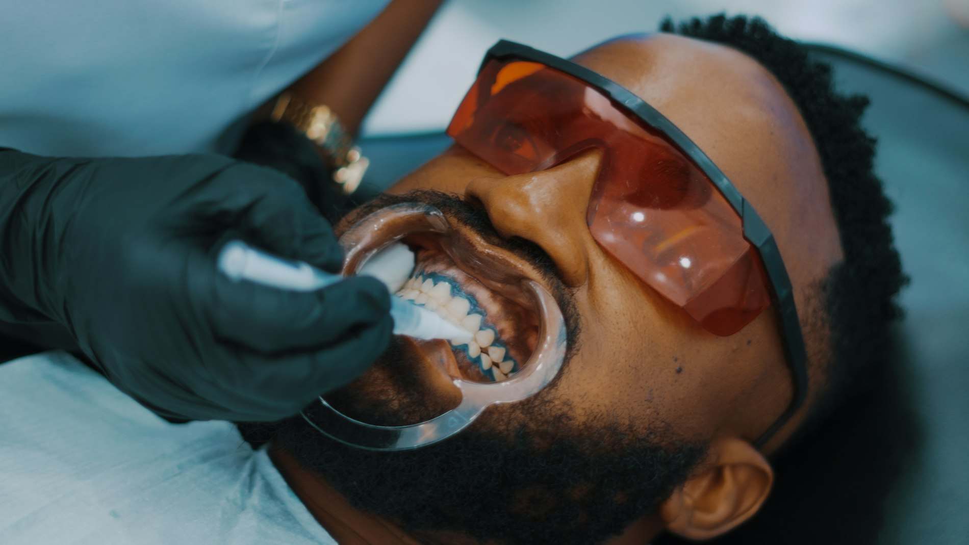 Paciente de óculos de proteção recebendo clareamento dental no consultório