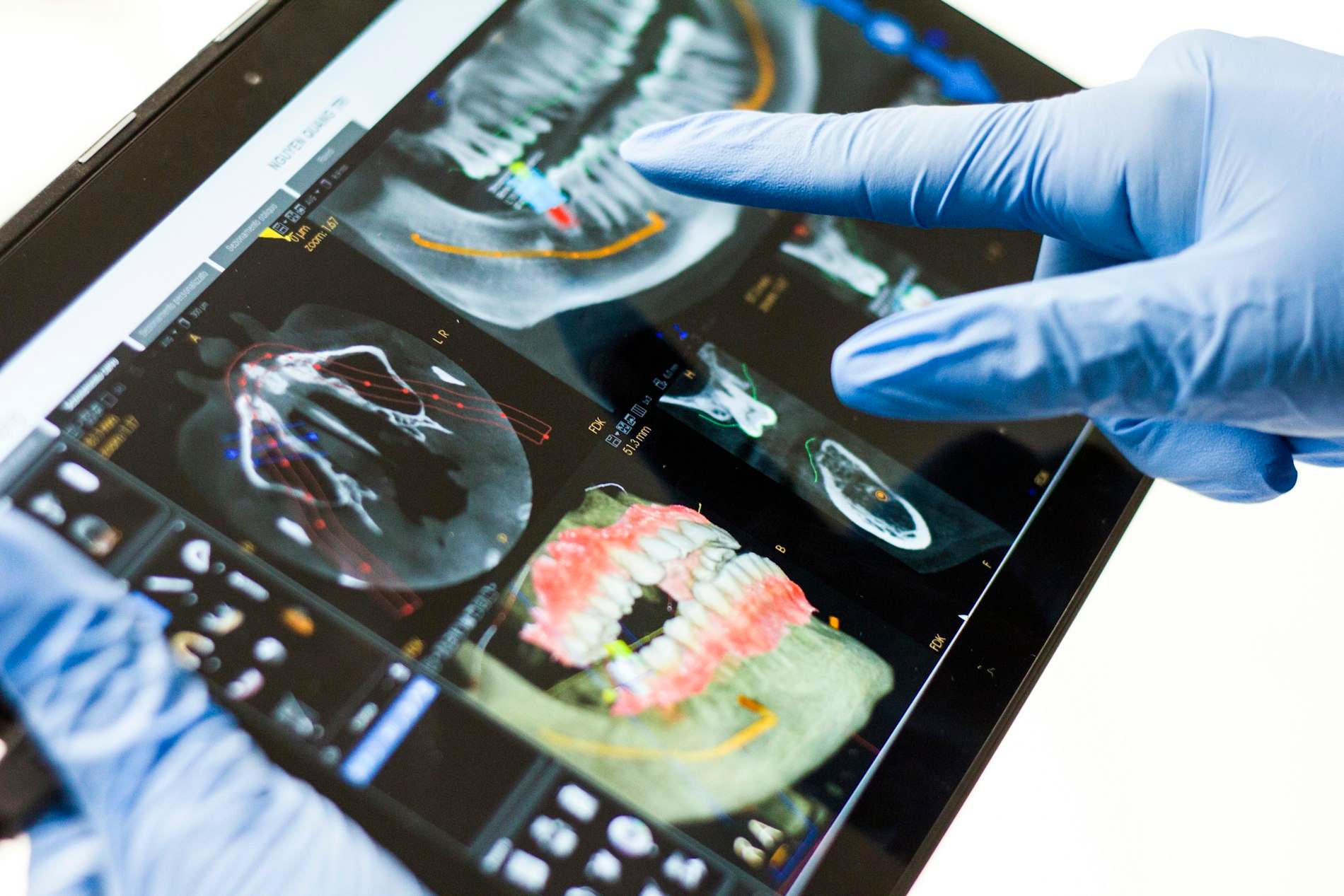 Dentista de luvas apontando um escaneamento digital da arcada num tablet