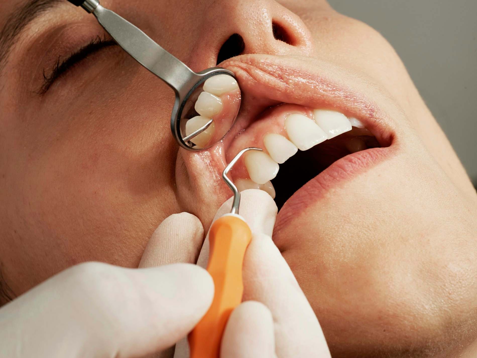 Dentista examinando a boca de um paciente com espelho e instrumento